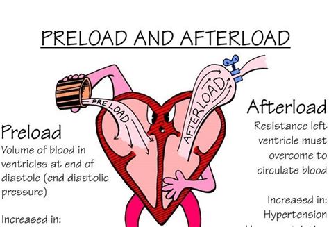 signs of decreased preload.